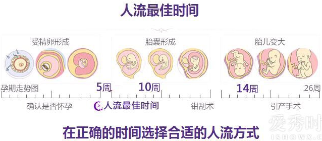 运城怀孕多长时间能做人流