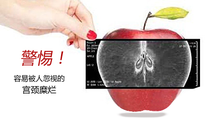 宫颈糜烂咨询