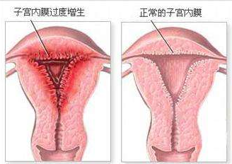 子宫不停的出血,用什么来拯救你的健康